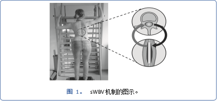 文献分享 | 基于家庭的振动辅助运动作为脊柱侧弯的新治疗选择